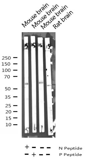Polyclonal Rabbit anti-Human SYT1 / Synaptotagmin Antibody (phospho-Thr202, IHC, IF, WB)