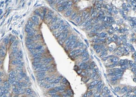 Polyclonal Rabbit anti-Human SYT1 / Synaptotagmin Antibody (phospho-Thr202, IHC, IF, WB)