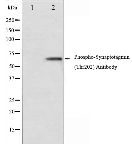 Polyclonal Rabbit anti-Human SYT1 / Synaptotagmin Antibody (phospho-Thr202, IHC, IF, WB)