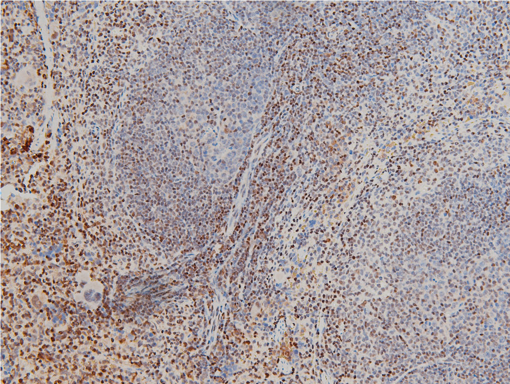 CFL1 / Cofilin Antibody (phospho-Ser3)