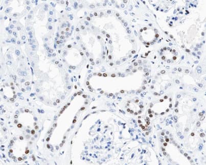 Polyclonal Rabbit anti-Human CCND3 / Cyclin D3 Antibody (phospho-Thr283, IHC, IF, WB)