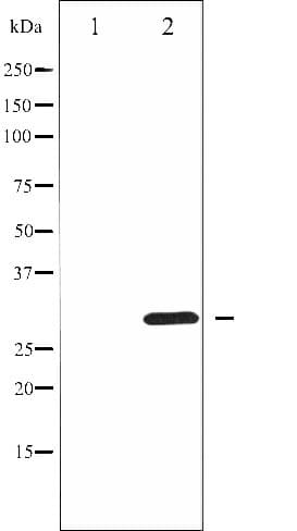 Polyclonal Rabbit anti-Human CCND3 / Cyclin D3 Antibody (phospho-Thr283, IHC, IF, WB)