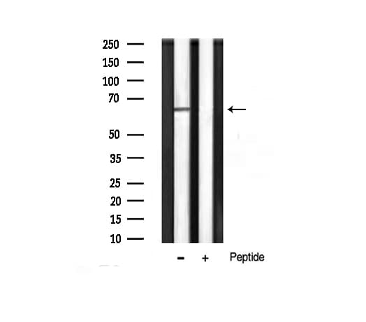 AKT1 Antibody (phospho-Thr450)