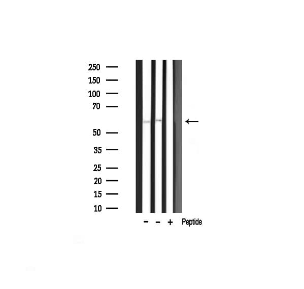 AKT1 Antibody (phospho-Thr450)