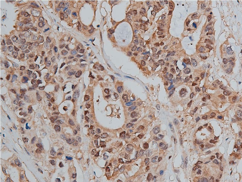 Polyclonal Rabbit anti-Human CTNNB1 / Beta Catenin Antibody (phospho-Ser33, IHC, IF, WB)