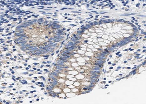 NOS2 / iNOS Antibody (phospho-Tyr151)