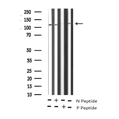 Polyclonal Rabbit anti-Human GRIA1 / GLUR1 Antibody (phospho-Ser863, IHC, IF, WB)