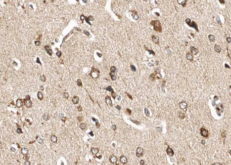 Polyclonal Rabbit anti-Human GRIA1 / GLUR1 Antibody (phospho-Ser863, IHC, IF, WB)