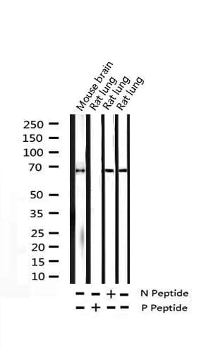 Polyclonal Rabbit anti-Human SYK Antibody (phospho-Tyr525, IHC, IF, WB)