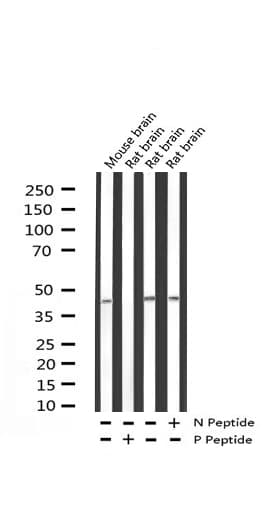 Polyclonal Rabbit anti-Human MAP2K4 / MKK4 Antibody (phospho-Ser80, IHC, WB)