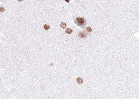 Polyclonal Rabbit anti-Human MAP2K4 / MKK4 Antibody (phospho-Ser80, IHC, WB)