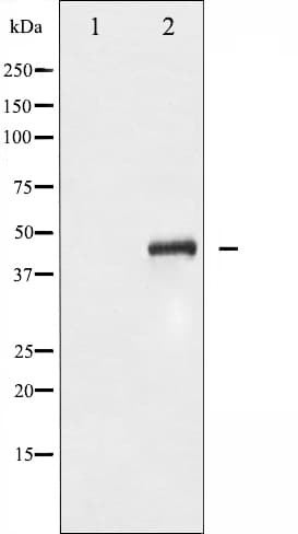 Polyclonal Rabbit anti-Human MAP2K4 / MKK4 Antibody (phospho-Ser80, IHC, WB)