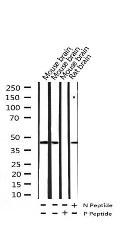 Polyclonal Rabbit anti-Human C/EBP Alpha / CEBPA Antibody (phospho-Ser21, IHC, IF, WB)