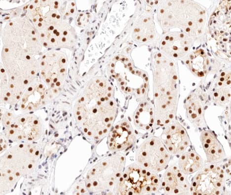 Polyclonal Rabbit anti-Human C/EBP Alpha / CEBPA Antibody (phospho-Ser21, IHC, IF, WB)