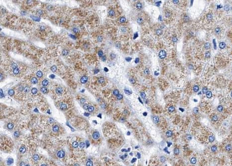 Polyclonal Rabbit anti-Human Tuberin / TSC2 Antibody (phospho-Thr1462, IHC, IF, WB)