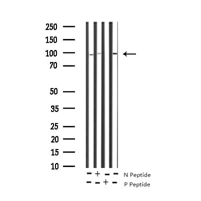 Polyclonal Rabbit anti-Human STAT5B Antibody (phospho-Ser731, IHC, WB)