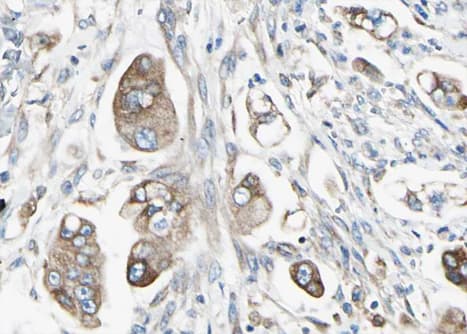 Polyclonal Rabbit anti-Human STAT5B Antibody (phospho-Ser731, IHC, WB)