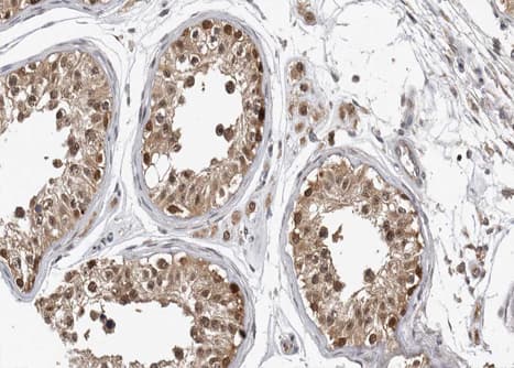 Polyclonal Rabbit anti-Human CASP9 / Caspase 9 Antibody (phospho-Thr125, IHC, IF, WB)
