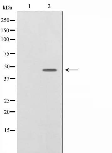 Polyclonal Rabbit anti-Human CASP9 / Caspase 9 Antibody (phospho-Thr125, IHC, IF, WB)