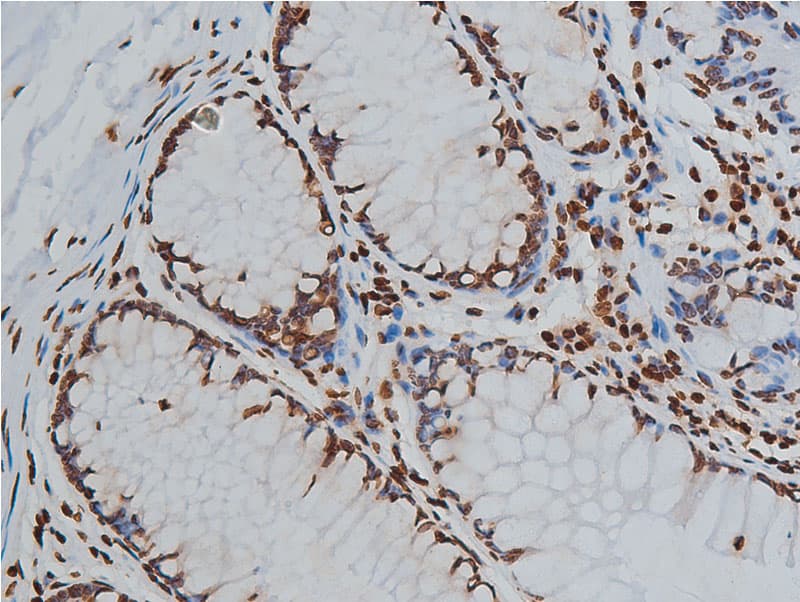 Histone H3 Antibody (Acetyl-Lys9)