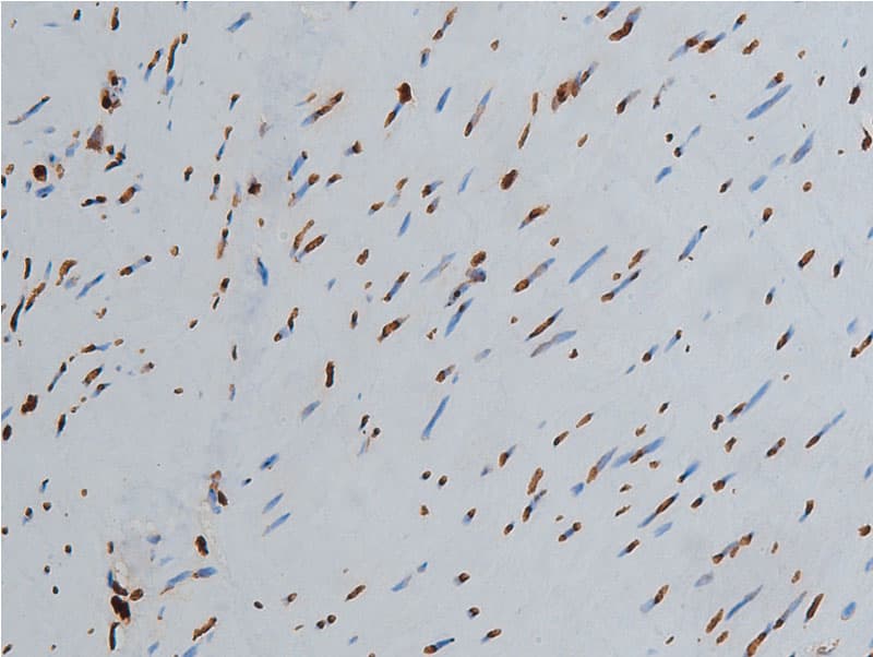Histone H3 Antibody (Acetyl-Lys9)