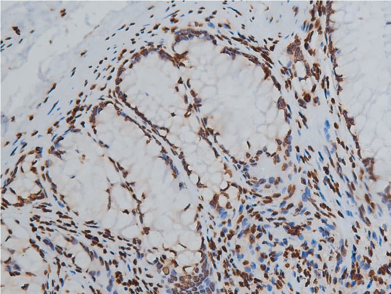 Histone H3 Antibody (Acetyl-Lys9)
