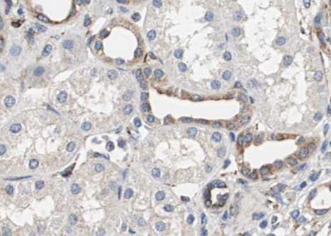 Polyclonal Rabbit anti-Human SMAD3 Antibody (phospho-Thr179, IHC, IF, WB)