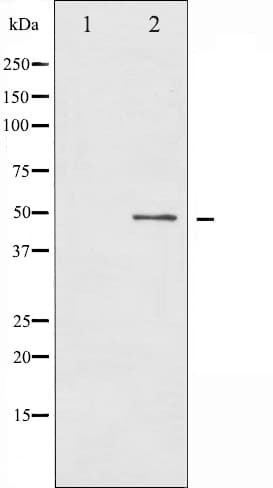 Polyclonal Rabbit anti-Human SMAD3 Antibody (phospho-Thr179, IHC, IF, WB)