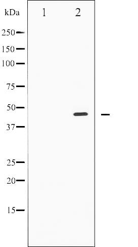 Polyclonal Rabbit anti-Human SMAD3 Antibody (phospho-Thr8, IHC, WB)