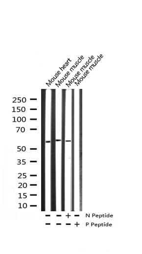 Polyclonal Rabbit anti-Human FOXO4 / AFX1 Antibody (phospho-Thr451, IHC, IF, WB)