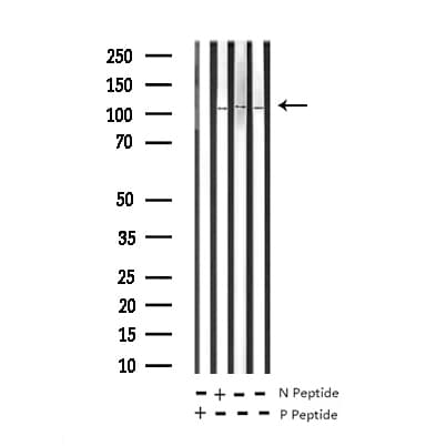 Polyclonal Rabbit anti-Human NFKB2 Antibody (phospho-Ser869, IHC, IF, WB)