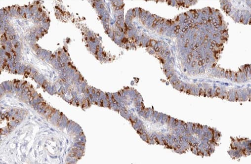Polyclonal Rabbit anti-Human NFKB2 Antibody (phospho-Ser869, IHC, IF, WB)