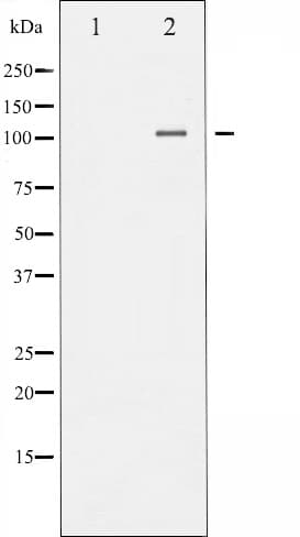 Polyclonal Rabbit anti-Human NFKB2 Antibody (phospho-Ser869, IHC, IF, WB)