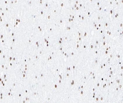 RELA / NFKB p65 Antibody (phospho-Ser276)