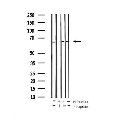 RELA / NFKB p65 Antibody (phospho-Ser529)