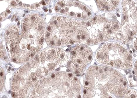 RELA / NFKB p65 Antibody (phospho-Ser529)