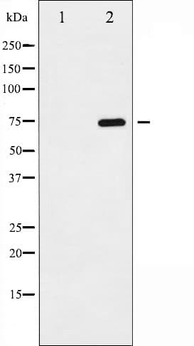 RELA / NFKB p65 Antibody (phospho-Ser529)