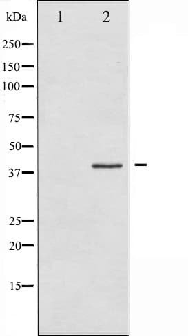 Polyclonal Rabbit anti-Human EIF2S1 Antibody (IHC, IF, WB)