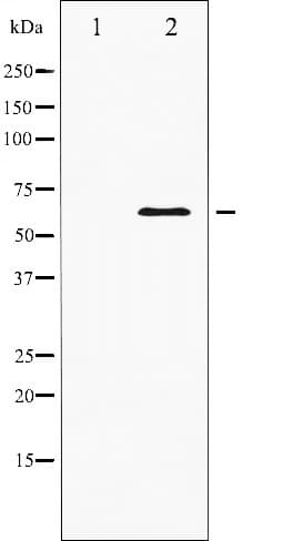 Polyclonal Rabbit anti-Human PDPK1 / PDK1 Antibody (IHC, WB)