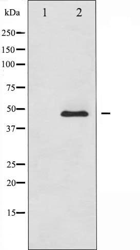 Polyclonal Rabbit anti-Human ADRB2 Antibody (IHC, IF, WB)
