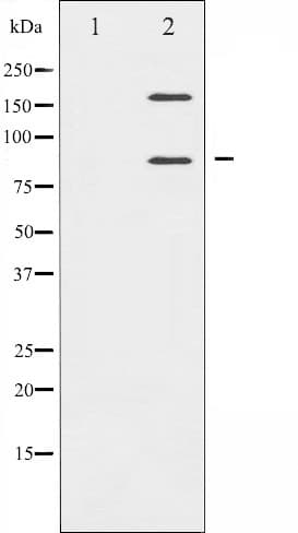 Polyclonal Rabbit anti-Human IGF1R / IGF1 Receptor Antibody (IF, WB)