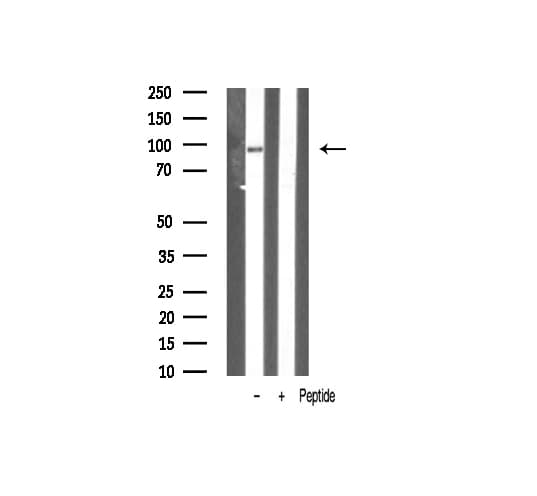 Polyclonal Rabbit anti-Human VAV1 / VAV Antibody (IHC, IF, WB)