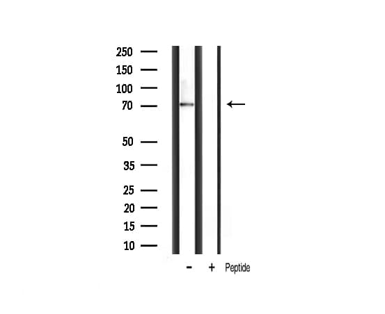 Polyclonal Rabbit anti-Human RPS6KB1 / P70S6K / S6K Antibody (IHC, IF, WB)
