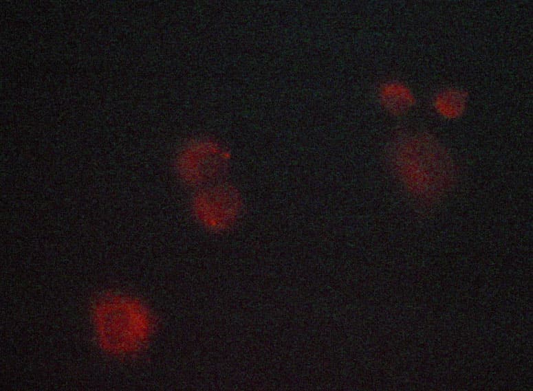 Polyclonal Rabbit anti-Human MAPK8 / JNK1 Antibody (IHC, IF, WB)