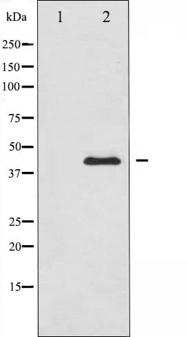 Polyclonal Rabbit anti-Human MAPK8 / JNK1 Antibody (IHC, IF, WB)