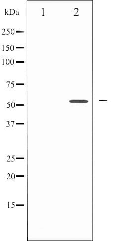 Polyclonal Rabbit anti-Human SMAD3 Antibody (IHC, IF, WB)