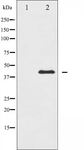 Polyclonal Rabbit anti-Human MAP2K1 / MKK1 / MEK1 Antibody (WB)