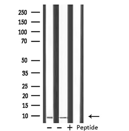 Polyclonal Rabbit anti-Human HMGN2 Antibody (IHC, IF, WB)