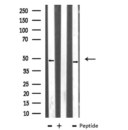 TEAD1 Antibody