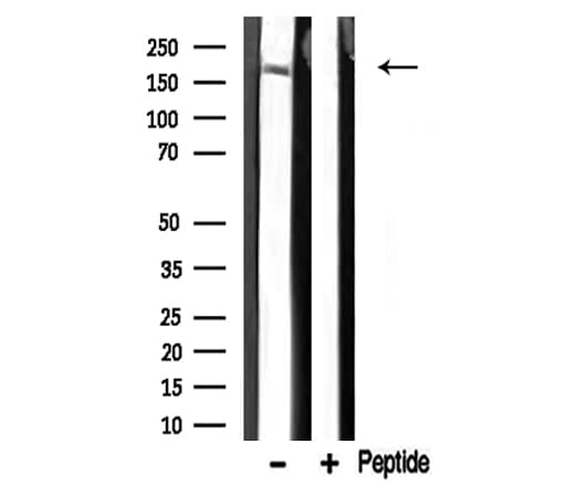Polyclonal Rabbit anti-Human MED1 / TRAP220 Antibody (IHC, IF, WB)